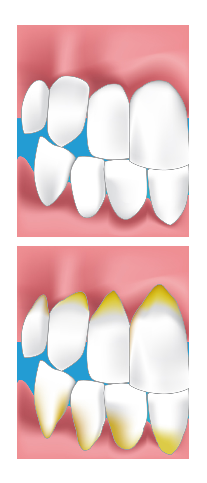 dentiste limoges